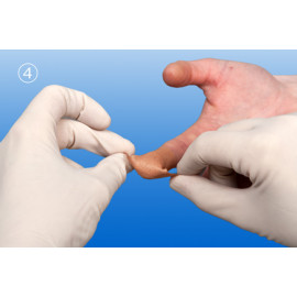 Steroplast Sterogauz Verband Rohr Umreifung Wunde Hand Finger